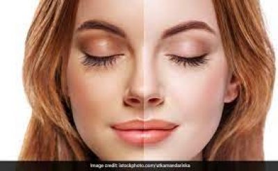 स्किन टैन को दूर करने के लिए अपनाएं ये घरेलू उपाय, निखर जाएगा चेहरा