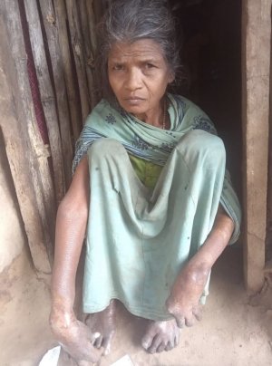 काग़ज़ों में हटाई गई, ज़मीन पर भूखी: विकलांग महिला राशन से वंचित