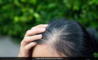 शरीर में इस चीज की कमी से जल्दी सफेद होते लगते हैं बाल, यहां जाने इसे बढ़ाने के उपाय