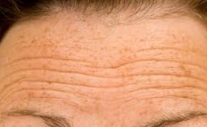 1 हफ्ते में गायब हो सकती है चेहरे की झुर्रियां बस घी में यह 1 चीज मिलाकर अप्लाई करें फेस पर